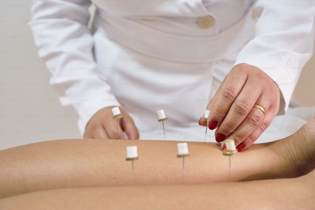 Diploma In Acupuncture (DIA)