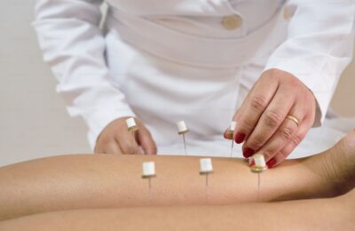 Diploma In Acupuncture (DIA)